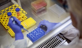 В Чеченской Республике за сутки выявили 32 случая коронавируса