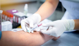 В Республиканской станции скорой помощи в 12:00 пройдет День открытых дверей