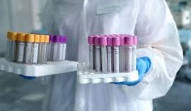 В России провели более 72,9 миллиона тестов на COVID-19