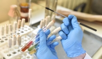 Более 47,2 миллиона тестов на COVID-19 провели в России