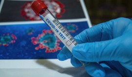 В Чеченской Республике зарегистрирован наименьший темп прироста случаев COVID-19 за сутки