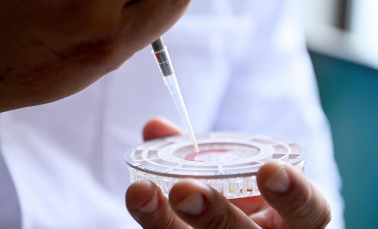 В России создан первый в мире быстрый тест для диагностики гепатита С